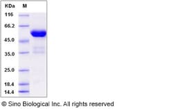 Sino Biological Recombinant Human FKBP7 Protein (hFc Tag), Quantity: Each