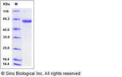 Sino Biological Human ERP27 Protein (Fc Tag) 100ug, Quantity: Each of 1