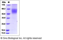 Sino Biological Recombinant Human CDCP1 Protein (Secreted Form, His Tag),