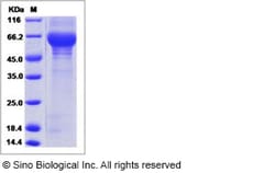 Sino Biological Recombinant Human LCAT Protein (His Tag), Quantity: Each