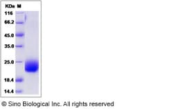 Sino Biological Recombinant Human CCDC47 Protein (His Tag), Quantity: Each