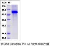 Sino Biological Recombinant Human alpha amylase/AMY2A Protein (His Tag),