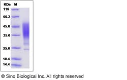 Sino Biological Recombinant Human ORM2 Protein (His Tag), Quantity: Each