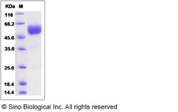 Sino Biological Recombinant Human TMEM27 Protein (hFc Tag), Quantity: Each