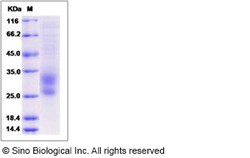 Sino Biological Recombinant Human TMEM27 Protein (His Tag), Quantity: Each