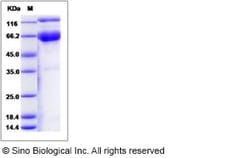 Sino Biological Recombinant Human EPCR Protein (hFc Tag), HPLC-verified,