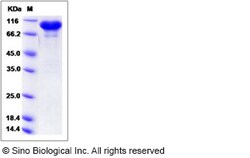 Sino Biological Recombinant Human ERP72 Protein (hFc Tag), Quantity: Each