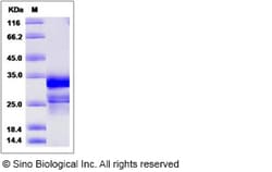 Sino Biological Human CNPY4 Protein (His Tag) 100ug, Quantity: Each of
