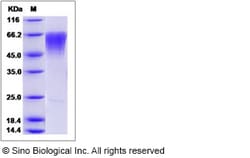 Sino Biological Recombinant Human CLM-9 Protein, Quantity: Each of 1