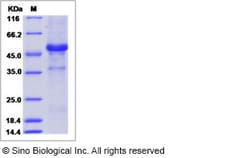 Sino Biological Human LECT1 Protein (Fc Tag) 100ug, Quantity: Each of 1