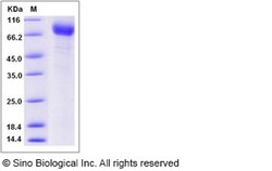 Sino Biological Recombinant Human TEM8/ANTXR1 Protein (hFc Tag), HPLC-verified,