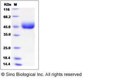 Sino Biological Recombinant Human LRG1 Protein, HPLC-verified, Quantity: