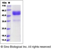 Sino Biological Recombinant Human TROY/TNFRSF19 Protein (hFc Tag), Quantity: