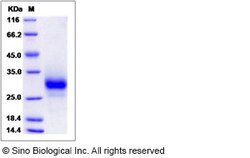 Sino Biological Human TNFRSF19 / TROY Protein (His Tag) 100ug, Quantity: