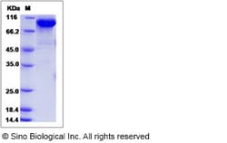 Sino Biological Recombinant Human FSTL5 Protein (His Tag), Quantity: Each