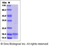 Sino Biological Recombinant Human MMP-26 Protein, Quantity: Each of 1