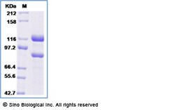 Sino Biological C5 Protein, Human, Recombinant (His & FLAG Tag), Quantity: