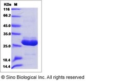 Sino Biological Human APOA1BP / AIBP Protein (His Tag) 100ug, Quantity: