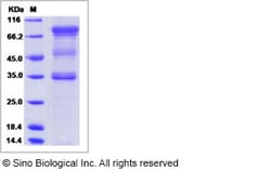 Sino Biological Recombinant Human UNC5A Protein (ECD, hFc Tag), Quantity: