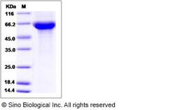 Sino Biological Recombinant Human IGSF8 Protein (His Tag), Quantity: Each
