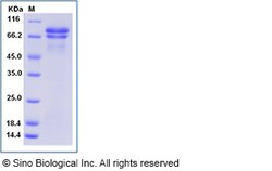 Sino Biological Recombinant Human Secretogranin II Protein (His Tag), Quantity: