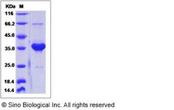 Sino Biological Recombinant Human SMR3B Protein (mFc Tag), Quantity: Each