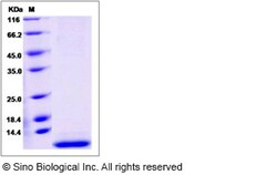 Sino Biological Recombinant Human SMR3B Protein (His Tag), Quantity: Each