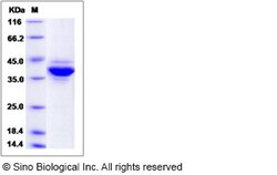 Sino Biological Recombinant Human JTB Protein (mFc Tag), Quantity: Each