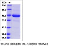 Sino Biological Recombinant Human ZG16 Protein (mFc Tag), Quantity: Each
