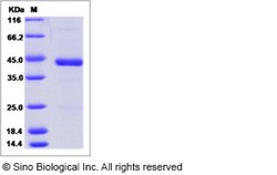 Sino Biological Recombinant Human SF20 Protein (mFc Tag), Quantity: Each