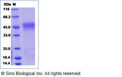Sino Biological Human OGN / osteoglycin protein (His Tag) 50ug, Quantity: