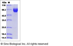 Sino Biological Recombinant Human VISTA/B7-H5 Protein (ECD, hFc Tag), HPLC-verified,