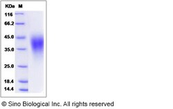 Sino Biological Recombinant Human VISTA/B7-H5 Protein (His Tag), HPLC-verified,