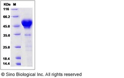 Sino Biological Recombinant Human Calumenin Protein (His Tag), Quantity: