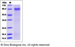 Sino Biological Human SUSD4 / Sushi domain-containing Protein 4 Protein