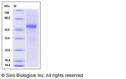 Sino Biological Recombinant Human ApoM Protein (hFc Tag), Quantity: Each