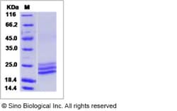 Sino Biological Recombinant Human ApoM Protein (His Tag), Quantity: Each