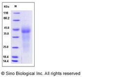 Sino Biological Recombinant Human GPR37 Protein (His Tag), Quantity: Each