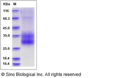 Sino Biological Human SCN3B Protein (His Tag) 100ug, Quantity: Each of