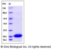 Sino Biological Recombinant Human TXNL4B Protein (His Tag), Quantity: Each