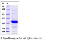 Sino Biological Recombinant Human PSPH Protein, Quantity: Each of 1