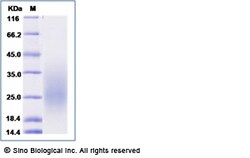 Sino Biological Recombinant Human PAR1 Protein (His Tag), HPLC-verified,