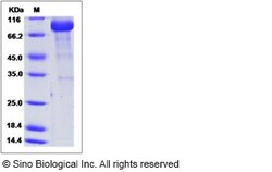 Sino Biological Recombinant Human PRELP Protein (mFc Tag), Quantity: Each