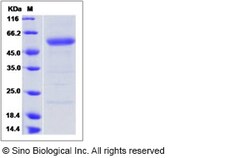 Sino Biological Recombinant Human PRELP Protein, Quantity: Each of 1
