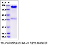 Sino Biological Recombinant Human Calreticulin/CALR Protein (hFc Tag),
