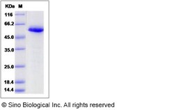 Sino Biological Recombinant Human Calreticulin/CALR Protein (His Tag),