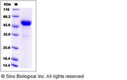 Sino Biological Human ART3 Protein (His Tag) 100ug, Quantity: Each of 1