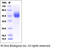 Sino Biological Human Dehydropeptidase-I / DPEP1 Protein (His Tag) 50ug,