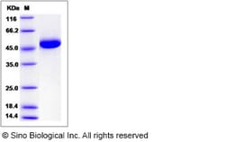 Sino Biological Recombinant Human Intrinsic Factor/CBLIF Protein (His Tag),