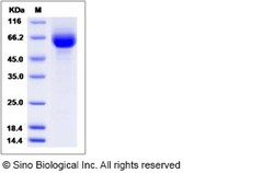 Sino Biological Human ILT6 / LILRA3 Protein (His Tag), Biotinylated 20ug,